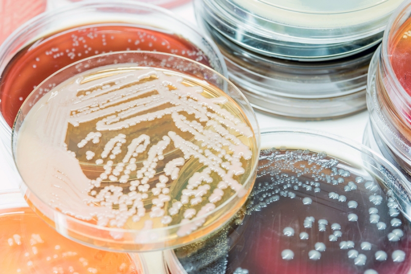 What is Viable Air Sampling? SanAir Technologies Laboratory, Inc.